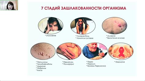 Как правильно провести очистку легких бананом