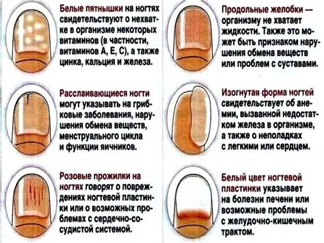 Основные причины появления полоски на хп