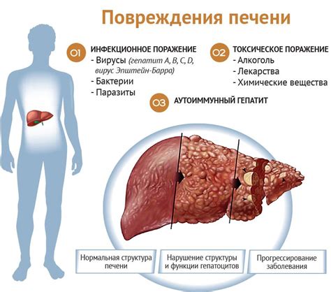 Причины и эффекты увеличения плаща по бокам